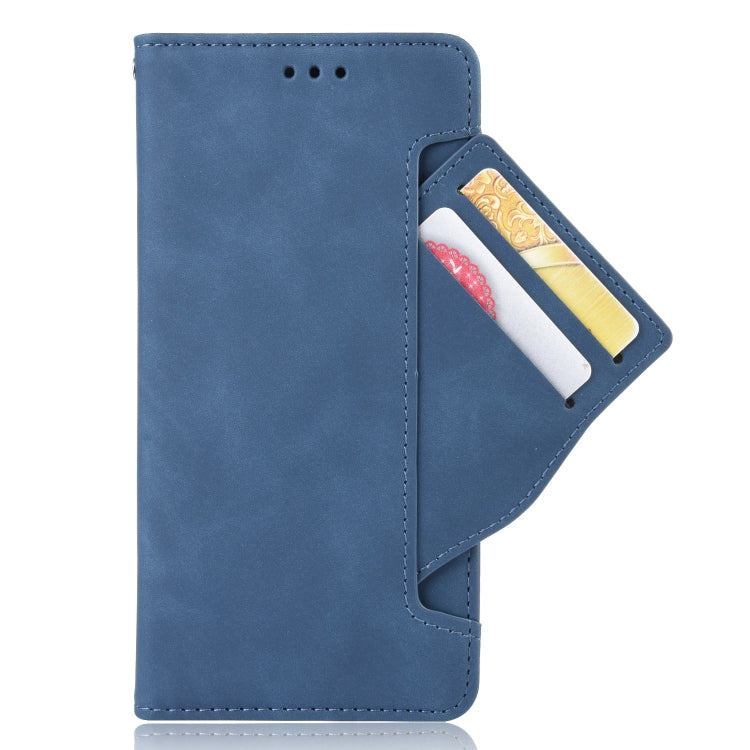 For Doogee N40 Pro Skin Feel Calf Pattern Horizontal Flip Leather Case with Holder & Card Slots & Photo Frame(Blue) - More Brand by PMC TechLife | Online Shopping South Africa | PMC TechLife | Buy Now Pay Later Mobicred