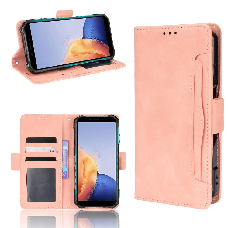 For Ulefone Armor X9 Skin Feel Calf Pattern Leather Phone Case(Pink) - Ulefone Cases by PMC Jewellery | Online Shopping South Africa | PMC Jewellery | Buy Now Pay Later Mobicred