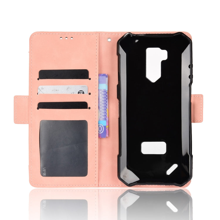 For Ulefone Armor X9 Skin Feel Calf Pattern Leather Phone Case(Pink) - Ulefone Cases by PMC Jewellery | Online Shopping South Africa | PMC Jewellery | Buy Now Pay Later Mobicred
