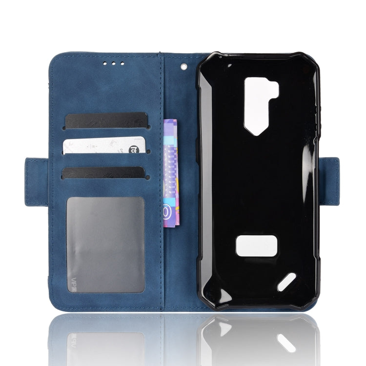 For Ulefone Armor X9 Skin Feel Calf Pattern Leather Phone Case(Blue) - Ulefone Cases by PMC Jewellery | Online Shopping South Africa | PMC Jewellery | Buy Now Pay Later Mobicred