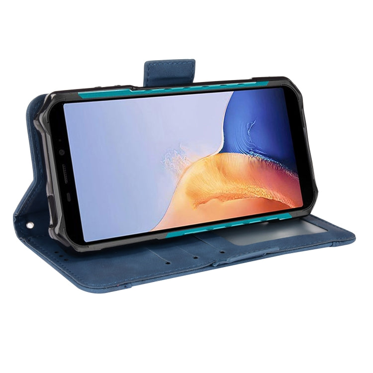 For Ulefone Armor X9 Skin Feel Calf Pattern Leather Phone Case(Blue) - Ulefone Cases by PMC Jewellery | Online Shopping South Africa | PMC Jewellery | Buy Now Pay Later Mobicred