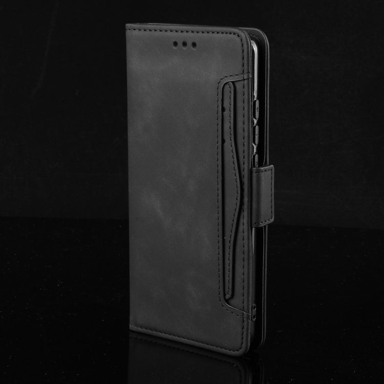 For Sony Xperia 10 VI 2024 Skin Feel Calf Texture Card Slots Leather Phone Case(Black) - Sony Cases by PMC Jewellery | Online Shopping South Africa | PMC Jewellery | Buy Now Pay Later Mobicred