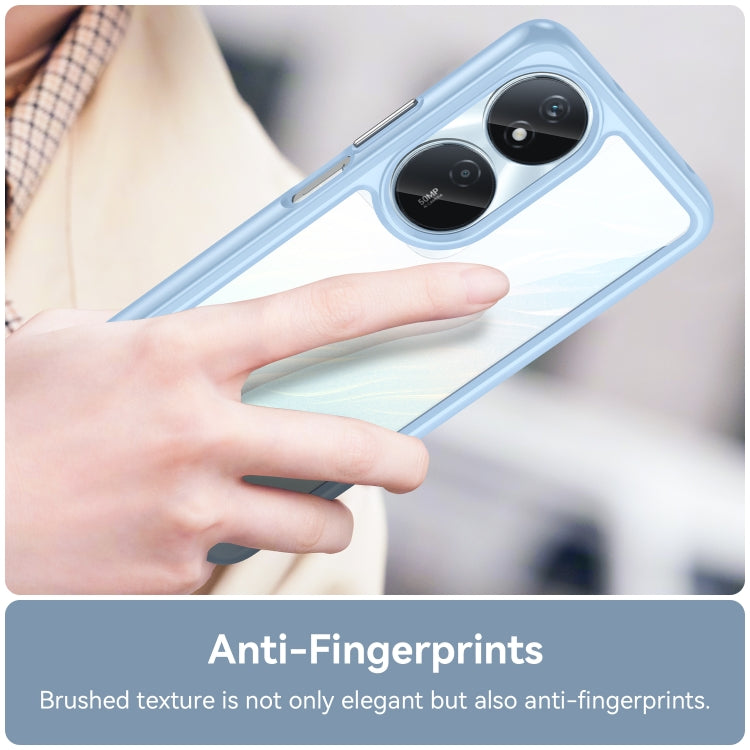 For Honor Play 50 Plus Colorful Series Acrylic Hybrid TPU Phone Case(Blue) - Honor Cases by PMC TechLife | Online Shopping South Africa | PMC TechLife | Buy Now Pay Later Mobicred