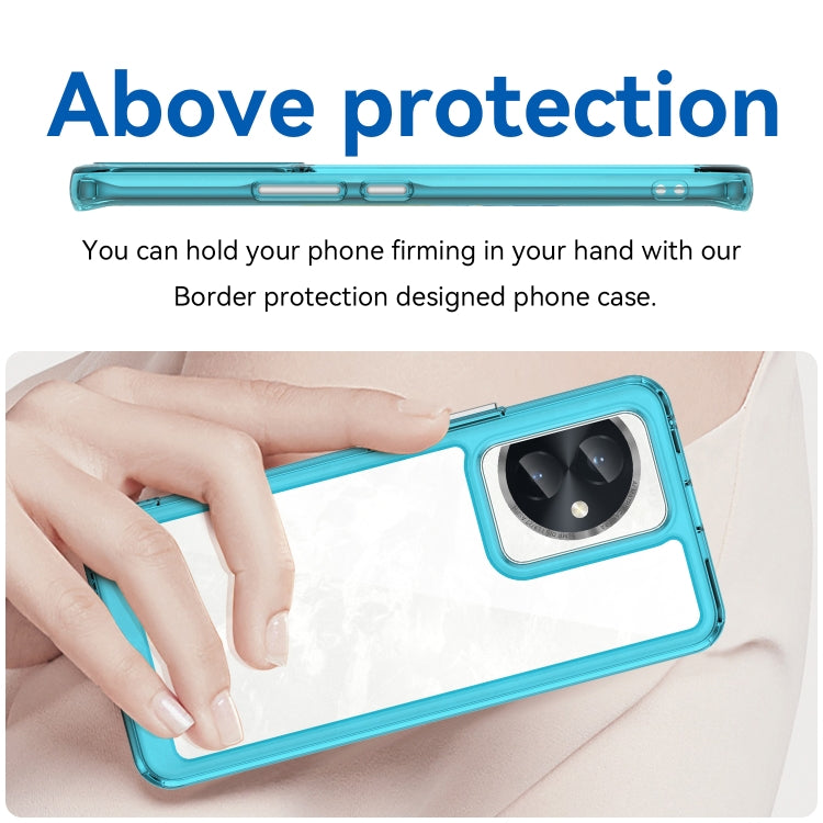For Honor 100 Colorful Series Acrylic Hybrid TPU Phone Case(Transparent Blue) - Honor Cases by PMC TechLife | Online Shopping South Africa | PMC TechLife | Buy Now Pay Later Mobicred
