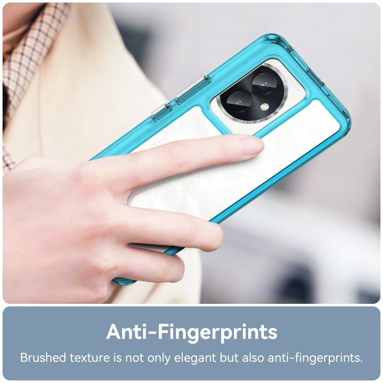 For Honor 100 Colorful Series Acrylic Hybrid TPU Phone Case(Transparent Blue) - Honor Cases by PMC TechLife | Online Shopping South Africa | PMC TechLife | Buy Now Pay Later Mobicred
