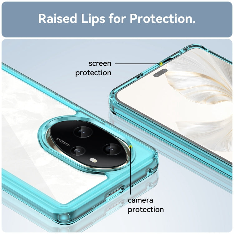 For Honor 100 Pro Colorful Series Acrylic Hybrid TPU Phone Case(Transparent Blue) - Honor Cases by PMC TechLife | Online Shopping South Africa | PMC TechLife | Buy Now Pay Later Mobicred