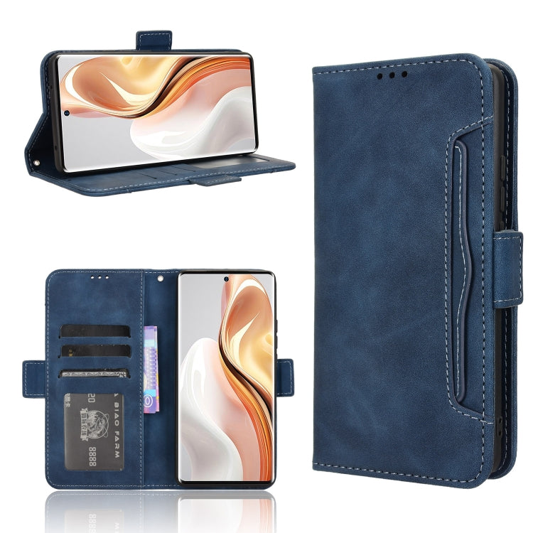 For Ulefone Note 17 Pro Skin Feel Calf Texture Card Slots Leather Phone Case(Blue) - Ulefone Cases by PMC Jewellery | Online Shopping South Africa | PMC Jewellery | Buy Now Pay Later Mobicred