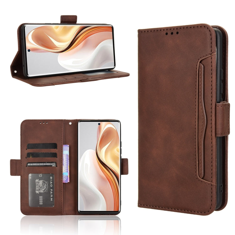 For Ulefone Note 17 Pro Skin Feel Calf Texture Card Slots Leather Phone Case(Brown) - Ulefone Cases by PMC Jewellery | Online Shopping South Africa | PMC Jewellery | Buy Now Pay Later Mobicred