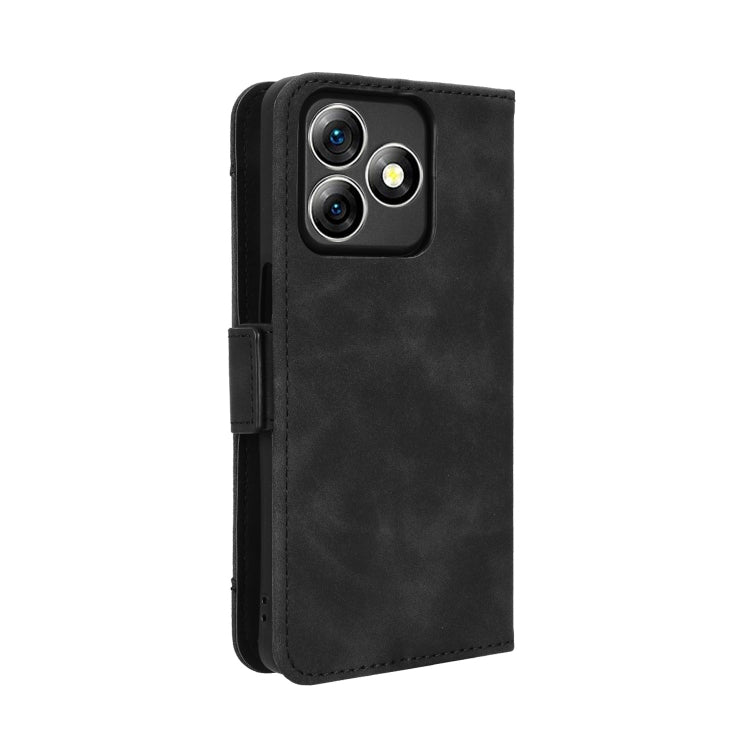 For Ulefone Note 18 Ultra Skin Feel Calf Texture Card Slots Leather Phone Case(Black) - Ulefone Cases by PMC Jewellery | Online Shopping South Africa | PMC Jewellery | Buy Now Pay Later Mobicred