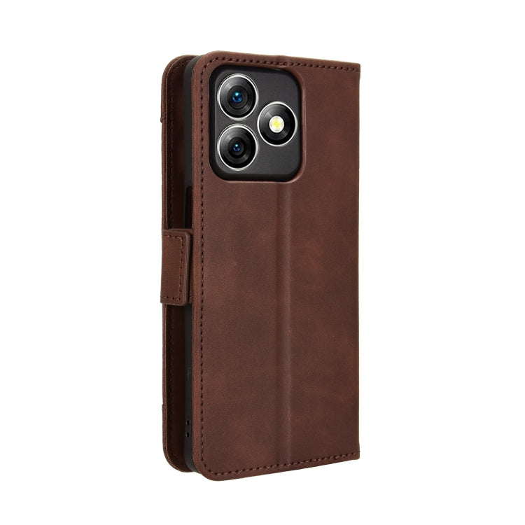 For Ulefone Note 18 Ultra Skin Feel Calf Texture Card Slots Leather Phone Case(Brown) - Ulefone Cases by PMC Jewellery | Online Shopping South Africa | PMC Jewellery | Buy Now Pay Later Mobicred