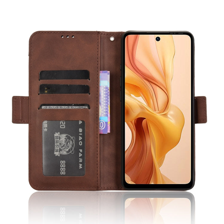 For Ulefone Note 18 Ultra Skin Feel Calf Texture Card Slots Leather Phone Case(Brown) - Ulefone Cases by PMC Jewellery | Online Shopping South Africa | PMC Jewellery | Buy Now Pay Later Mobicred