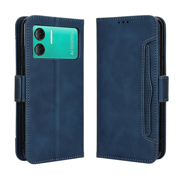 For Doogee X98 Skin Feel Calf Texture Card Slots Leather Phone Case(Blue) - Doogee Cases by PMC TechLife | Online Shopping South Africa | PMC TechLife | Buy Now Pay Later Mobicred