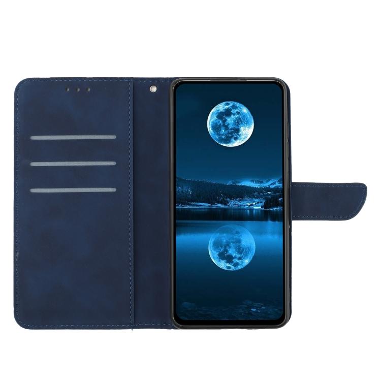 For Tecno Pova 7 4G Stitching Embossed Leather Phone Case(Blue) - free shipping - PMC TechLife - Order now!
