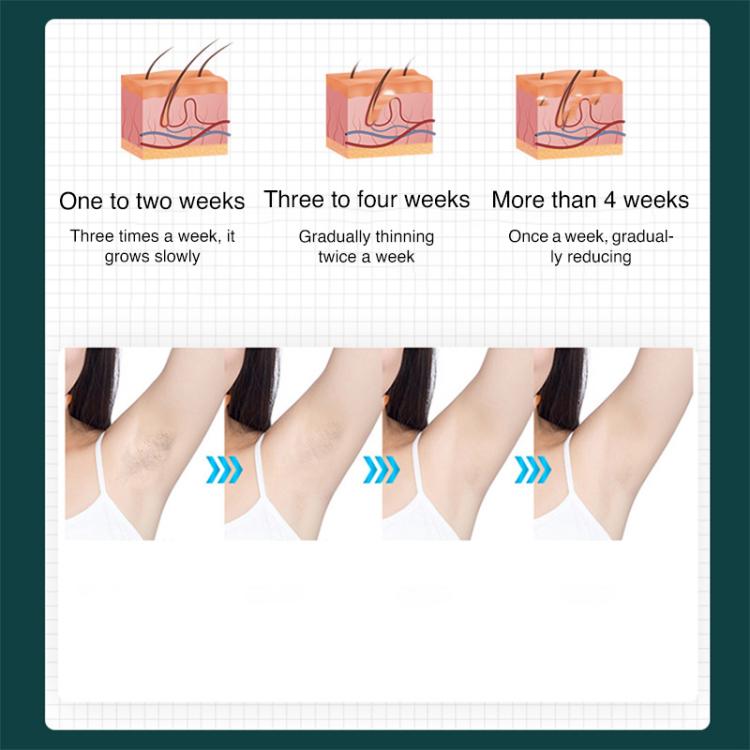 FY-B501 Laser Hair Removal Device Home Electric IPL Intense Pulse Hair Remover, EU Plug(Dark Green) - free shipping - PMC TechLife - Order now!