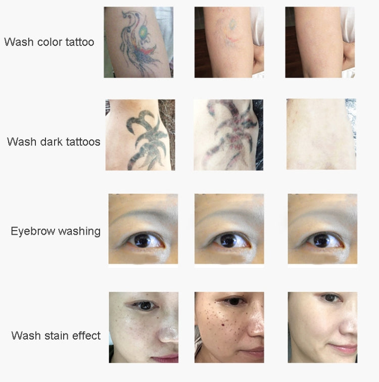 Laser Tattoo Removal Machine Non-invasive Eyebrow Washing Beauty Equipment(UK Plug) - free shipping - PMC TechLife - Order now!