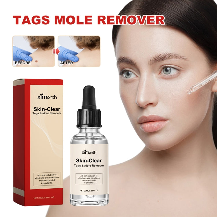 Ximonth 20ml/Bottle Anti Mole And Wart Liquid Dark Spot Tag Remover Skin Essence - free shipping - PMC TechLife - Order now!