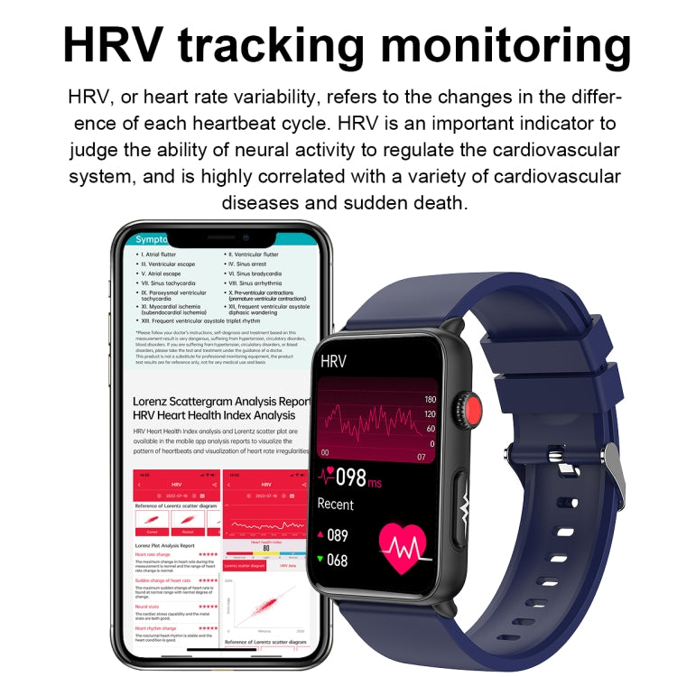 Smart Watch Ring ECG Temperature Heart Rate Blood Pressure Health Bluetooth Talking Watch, Color: Blue Silicone - Smart Wristbands by PMC TechLife | Online Shopping South Africa | PMC TechLife | Buy Now Pay Later Mobicred
