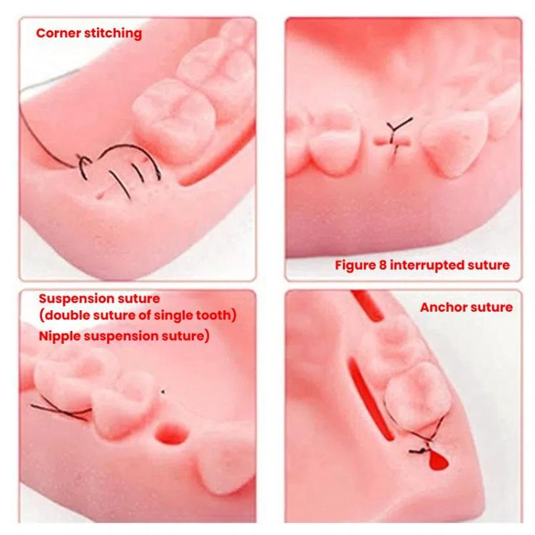 Gums Multiple Wounds Silicone Suture Practice Mold Four Teeth Oral Surgery Training Module For Medical Students - free shipping - PMC TechLife - Order now!