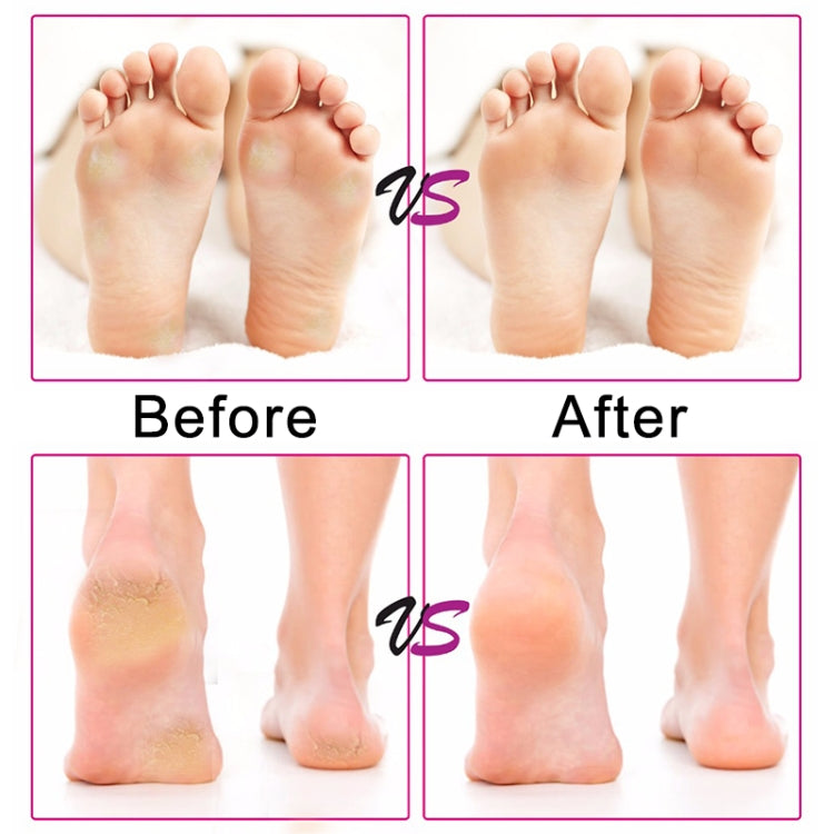 Electric Foot File Speed Adjustable Sandpaper Discs Callus Remover Pedicure Fast Remove Feet Hard Cracked Dry Dead Skin Tool, Plug Type:US plug(Pink) - Grinding Tools & Accessories by PMC TechLife | Online Shopping South Africa | PMC TechLife | Buy Now Pay Later Mobicred