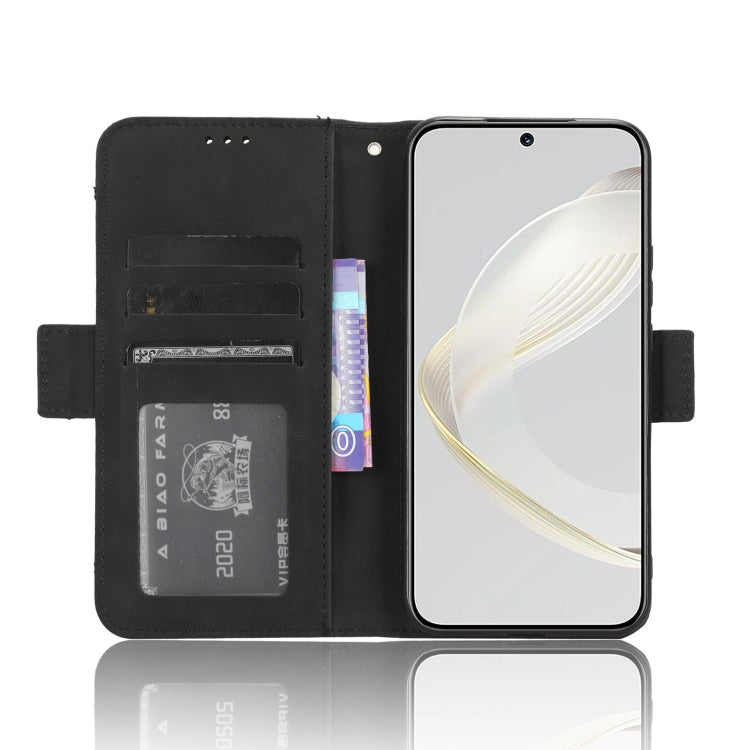 For Huawei nova 11 Skin Feel Calf Texture Card Slots Leather Phone Case(Black) - free shipping - PMC TechLife - Order now!