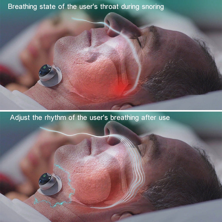 Adult Home Smart Throat Anti-snoring Device Sleep Stickers - Anti Snoring Tools by PMC TechLife | Online Shopping South Africa | PMC TechLife