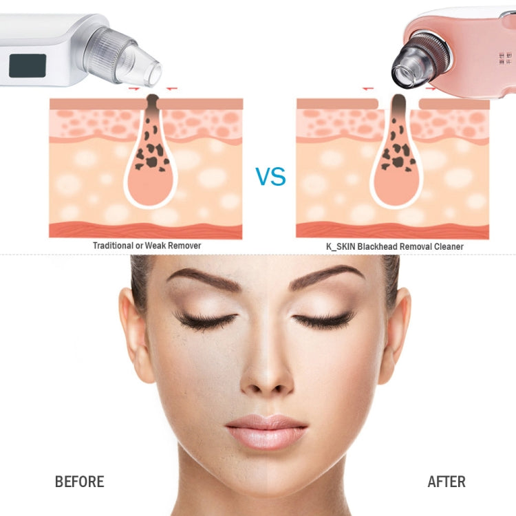 K-SKIN KD803A 3 Level Intensity Blackhead Removal Pore Cleaner Suction Rechargeable Black Spot Cleaner Facial Cleaning Machine - free shipping - PMC TechLife - Order now!