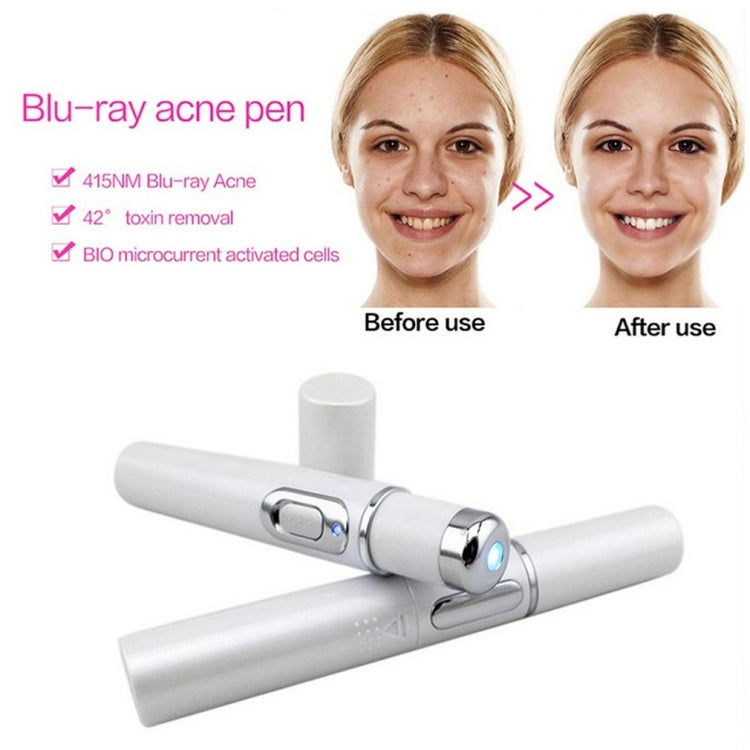 K-SKIN KD-7910 Acne Laser Pen Portable Wrinkle Removal Machine Durable Soft Scar Remover Device Blue Light Therapy Pen - free shipping - PMC TechLife - Order now!