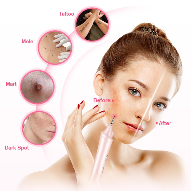 K-SKIN KD306 Laser Spotting Machine Plasma Pen Dark Eyelash Remover for Facial Spasm Removal Tattoo Skin Care(White) - free shipping - PMC TechLife - Order now!