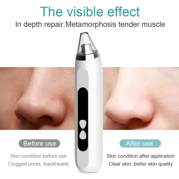 Blackhead Remover Vacuum Pore Cleaner Facial Deep Cleaning Beauty Tools(White) - Cleanser by PMC TechLife | Online Shopping South Africa | PMC TechLife
