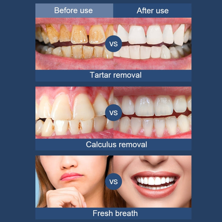 Ultrasonic Electric Scaler Home Dental Cleaner Portable Scaling Instrument(White) - free shipping - PMC TechLife - Order now!